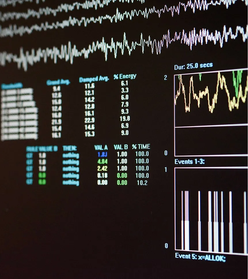Pantalla con registro de actividad eléctrica cerebral
